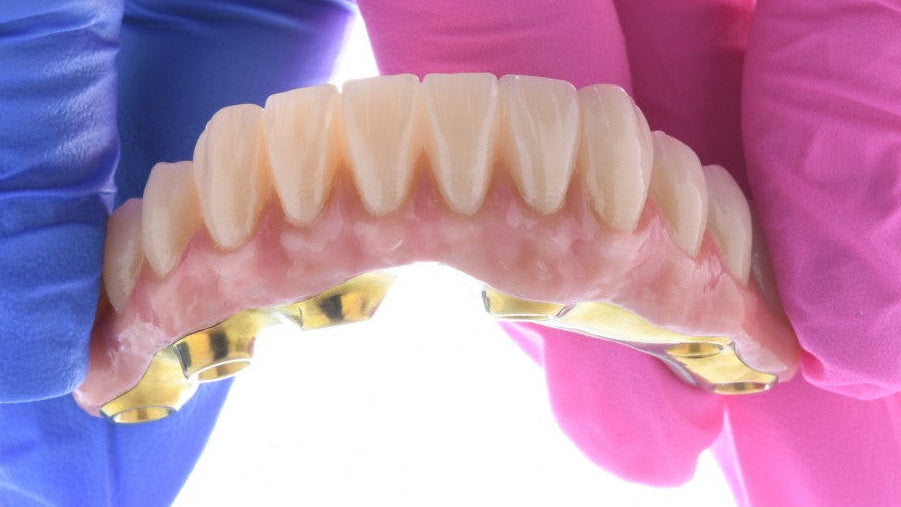 Dental model with teeth held by gloved hands on a white background