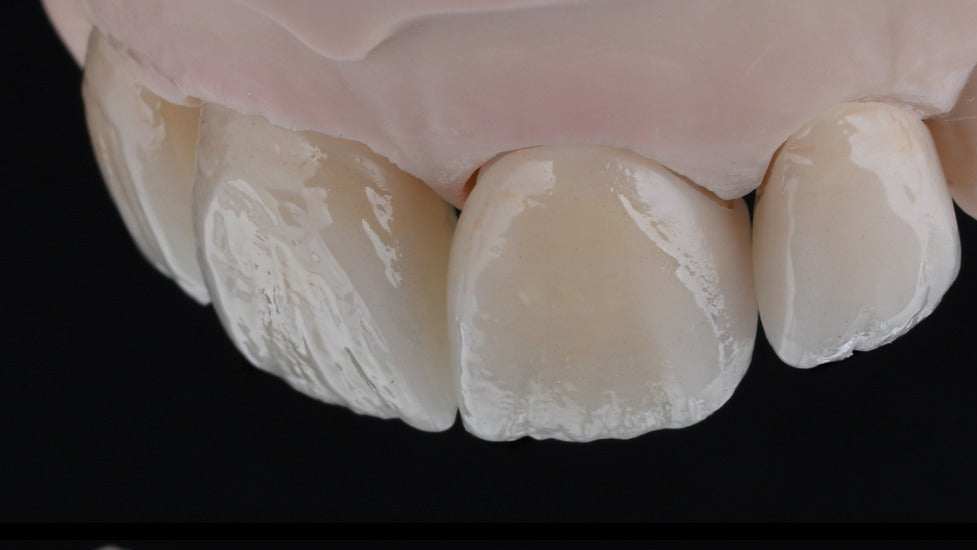 Close-up of dental crowns with '#THEVIVOWAY' text on a black background