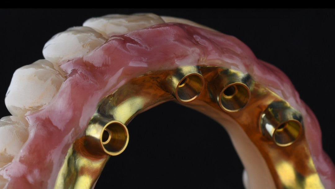 Bioengineered dental implants with gold and silver components on a black background.