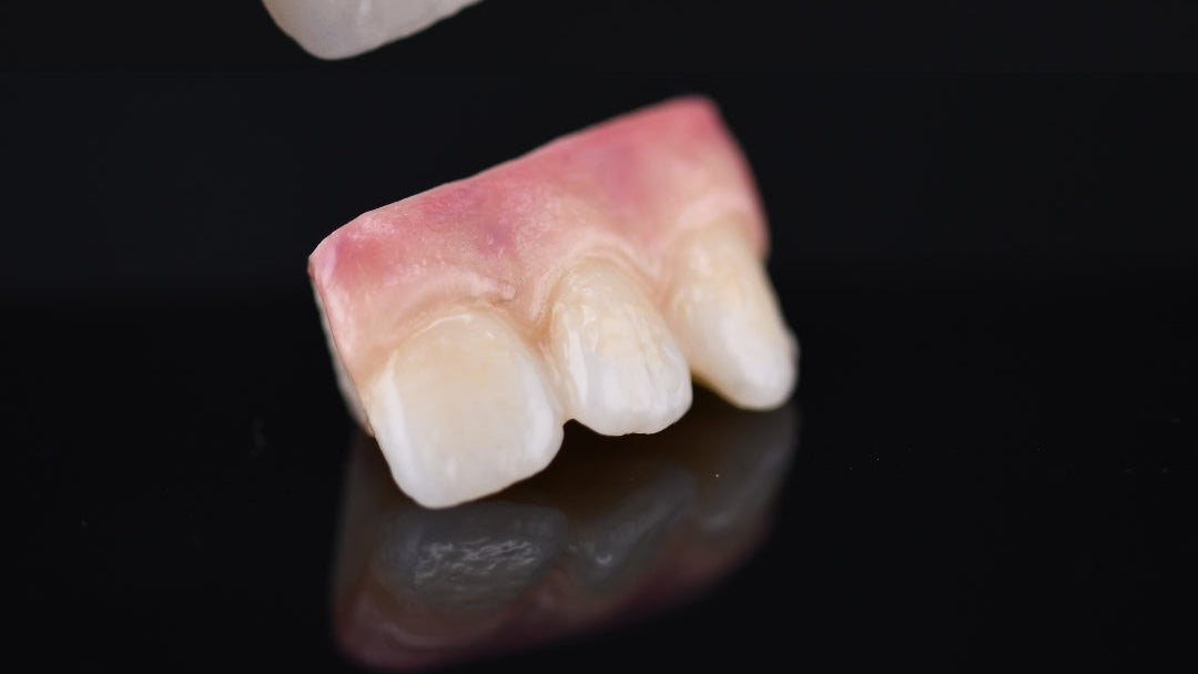 Two dental models on a black background with 'CeramicStudios' branding.
