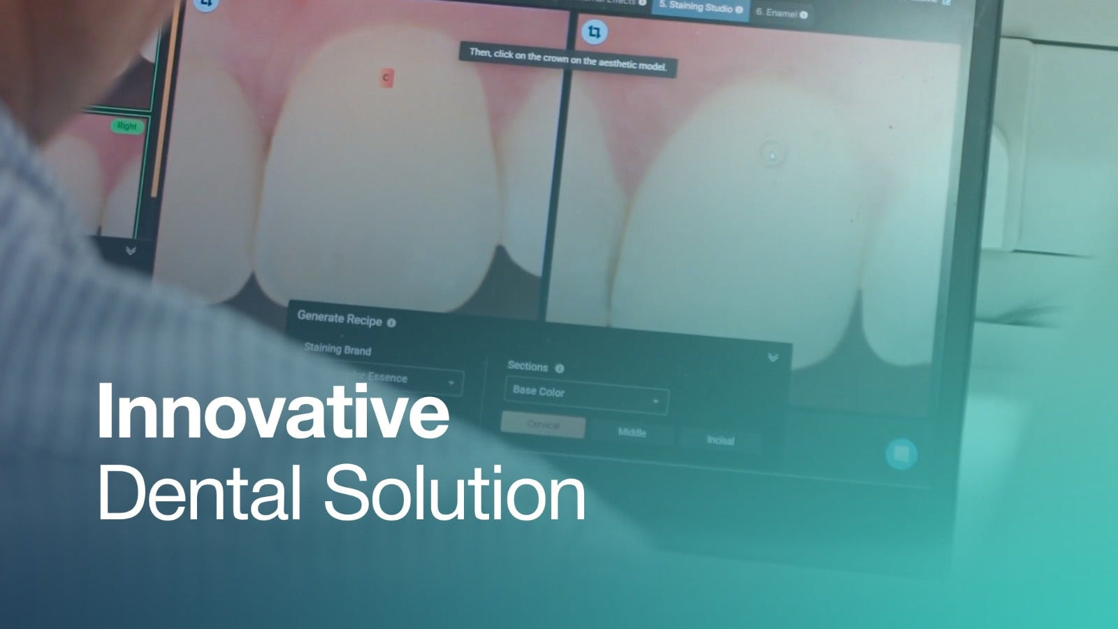 Person using a computer with dental software on the screen, labeled 'Innovative Dental Solution'.